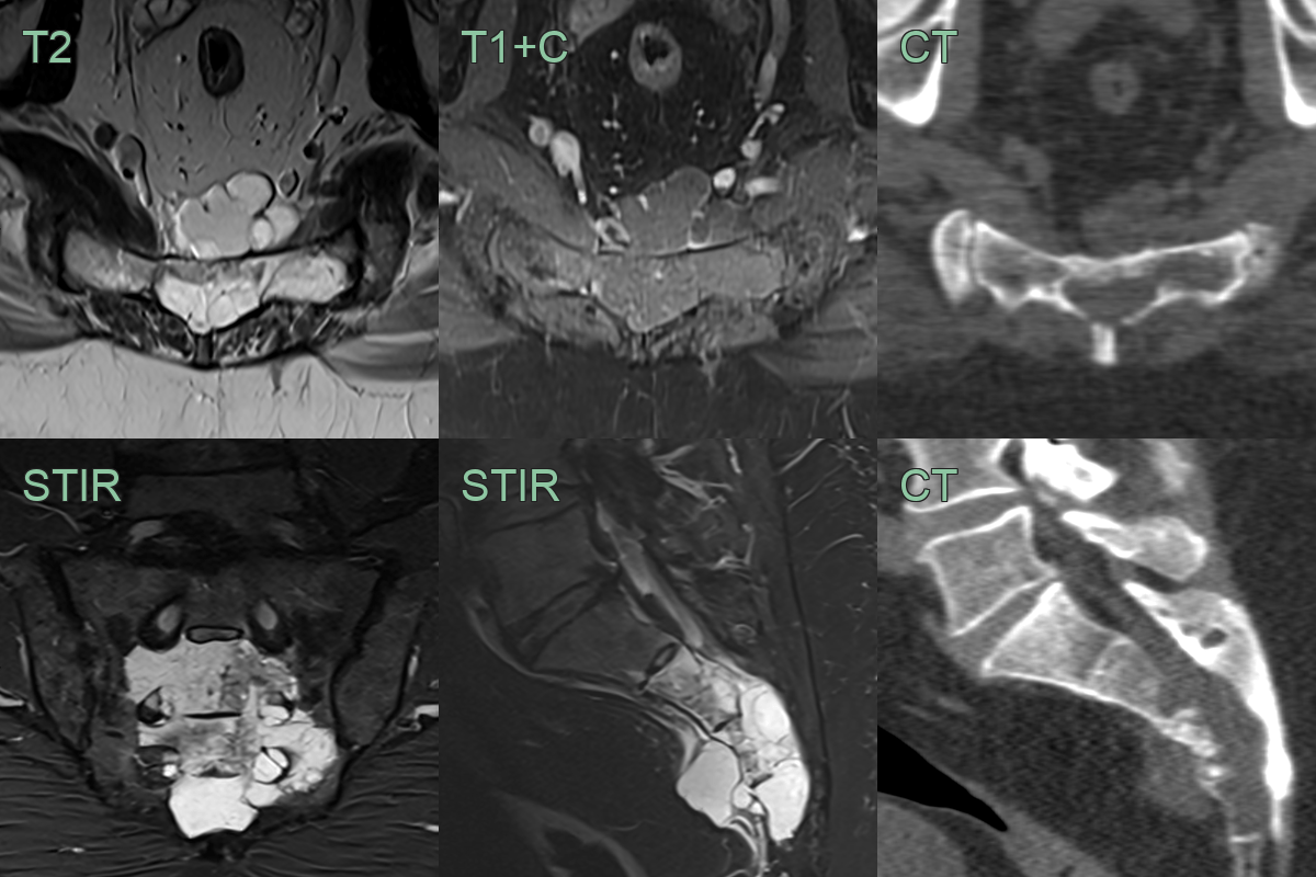 panels-1