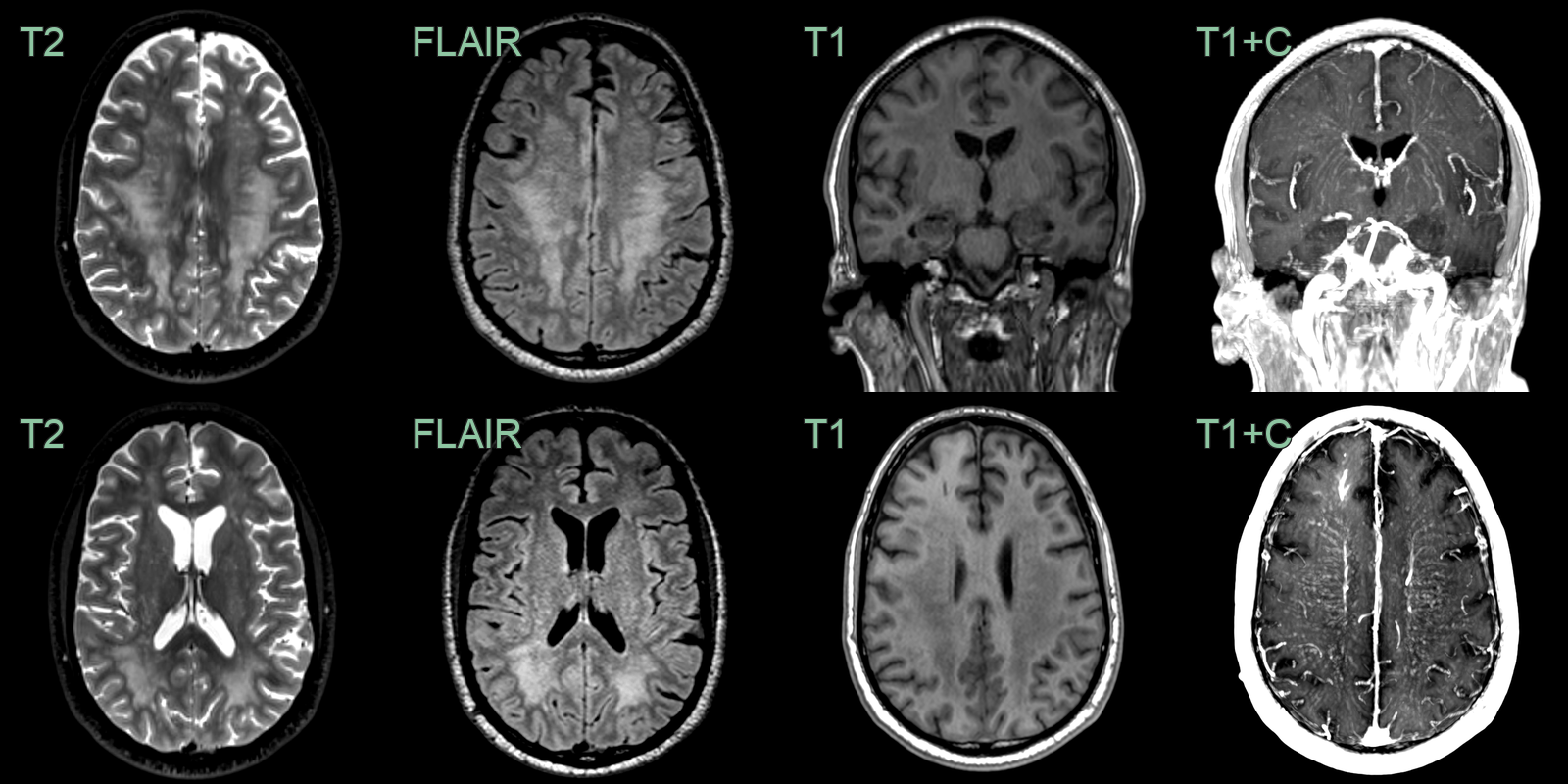 panels-1